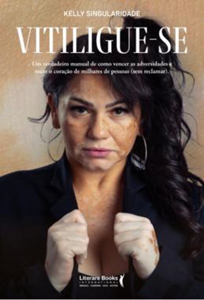 Picture of VITILIGUE-SE - UM VERDADEIRO MANUAL DE COMO VENCER AS ADVERSIDADES E TOCAR O CORACAO DE MILHARES DE PESSOAS (SEM RECLAMAR)